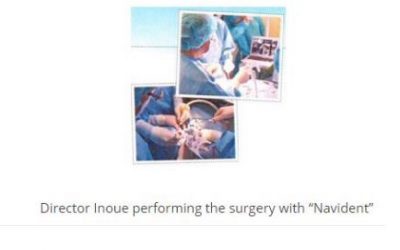 To make the implant surgery safe and secure Implant Navigation System Introduction of “Navident”